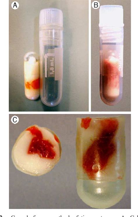 Snap Freeze Tissue Protocol