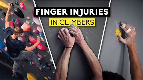 Finger Injuries In Climbers Lattice Training X Sheffield Climbing