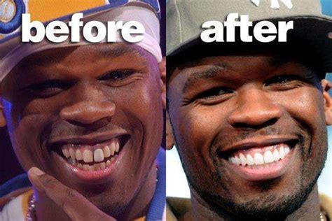 Did You Know This Famous Rapper Has Had A Smile Makeover Its Simple