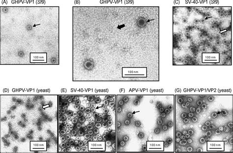 Demonstration Of Vlp Formation After Expression Of Vp1 In Sf9 Cells