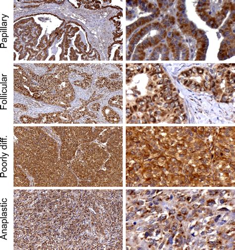 Representative Microphotographs Of Immunohistochemical Staining Of