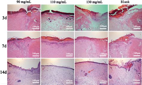 Histological Sections Of The Wound Were Stained With Hematoxylin And