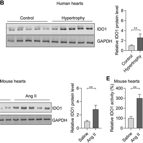 The Expression And Activity Of Ido1 Are Increased In Hypertrophic