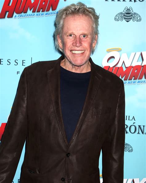 Gary Busey Accident Before And After
