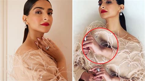 सोनम कपूर के हाथ पर चोट का निशान छ‍िपाना चाहा लेकिन इस फोटो में दिख गया Did Sonam Kapoor Got