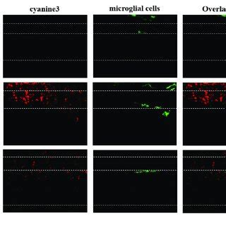 Microglial Cells In Sections Of The Ex Vivo Mouse Retina Labelled With