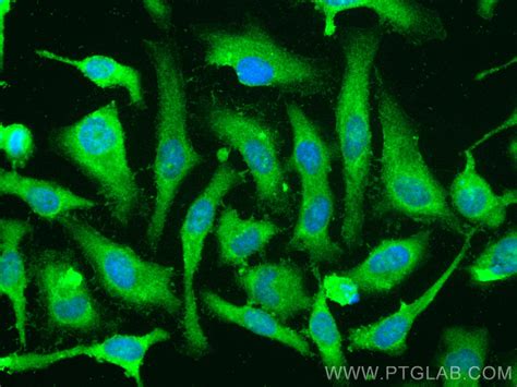 Gsdmd Antibody Cl488 20770 Proteintech