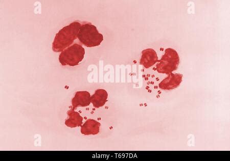 Neisseria Gonorrhoeae Gram Negativas Varillas Intracelular Revelada En