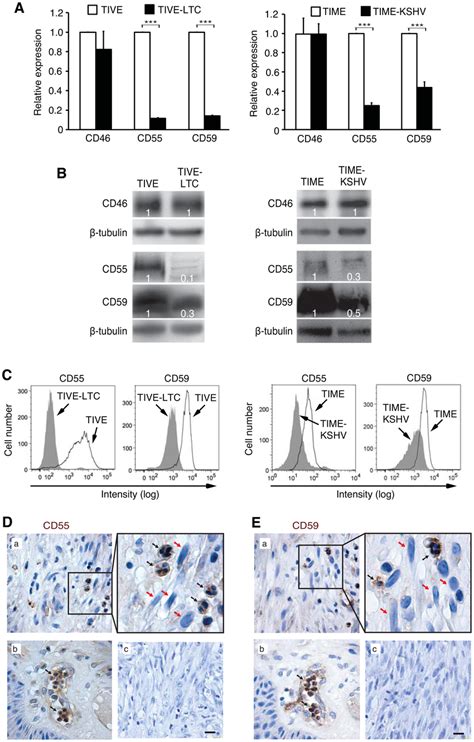 Complement Regulatory Proteins Cd55 And Cd59 But Not Cd46 Are