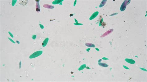 Euglena Under Microscope With 200 Times Magnification On Bright Field Background Stock Video