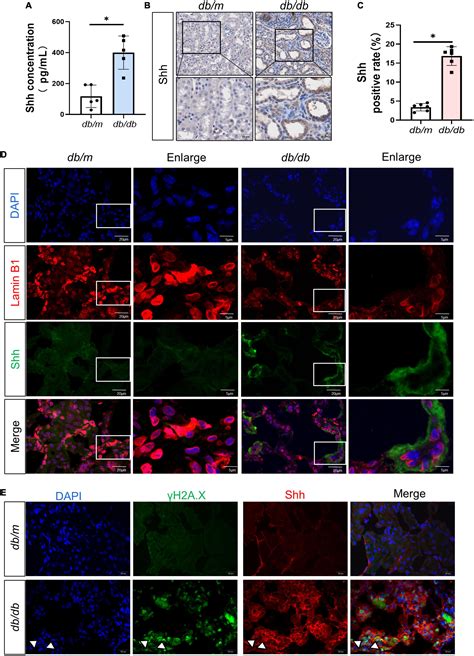 Frontiers Senescent Renal Tubular Epithelial Cells Activate