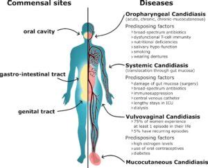 How fecal bifidobacteria inhibit pathogenic Candida albicans