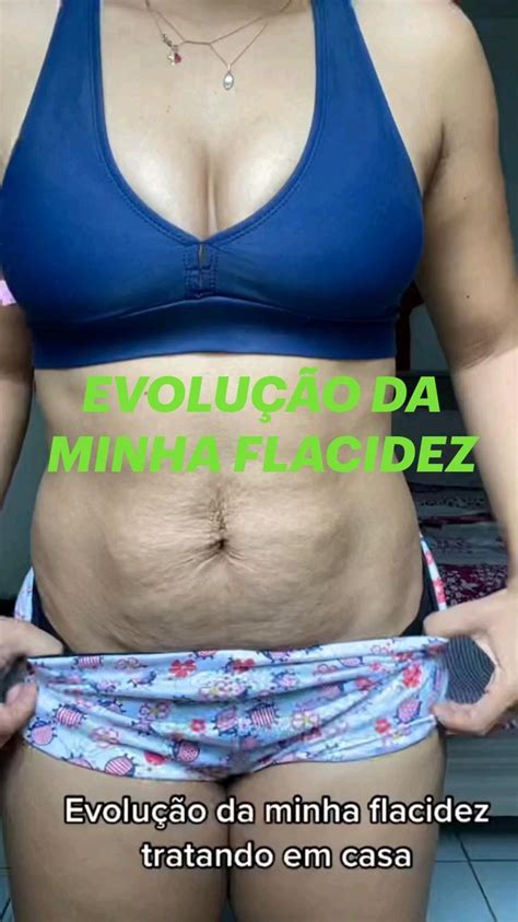 Diastase Na Gravidez Como Diminuir A Barriga Barriga Pos Parto