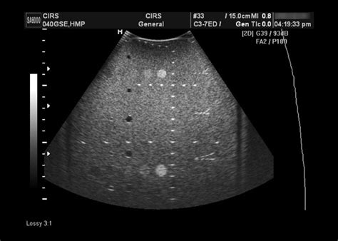 Zerdine Ultrasound Phantoms Sun Nuclear