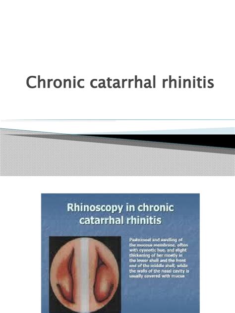 Chronic Catarrhal Rhinitis Download Free Pdf Human Nose Mucus