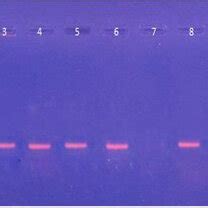 A Ethidium Bromide Stained Agarose Gel Electrophoresis Of PCR