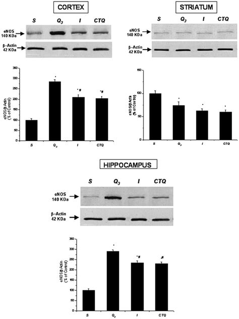 Western Blotting Of Enos Expression In Three Cerebral Zones Cortex Download Scientific