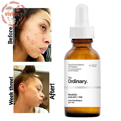 The Ordinary Mandelic Acid 10 HA 30ml Shopee Malaysia