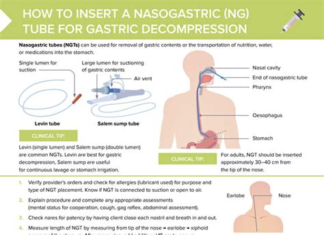 Ng Tube Indications And Contraindications Elpilarrancagua Cl