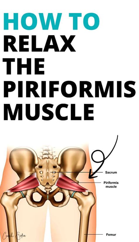 Pin On Piriformis Syndrome Relief