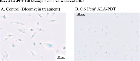 Figure From The Influence Of Photodynamic Therapy With