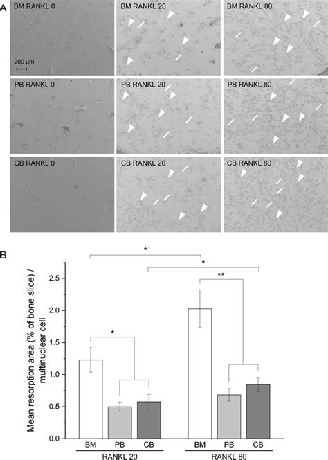 Bone resorption activity of osteoclasts differentiated from BM, PB and ...