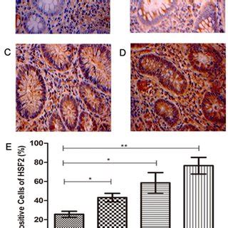 Expression Of HSF2 In Colonic Mucosa Tissues Of UC Was Examined By