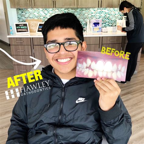 How can Invisalign and Braces Change Your Face Shape? | Hawley Orthodontics