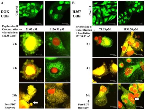 Confocal Laser Scanning Microscopy Clsm Analysis Clsm Images Of Dok