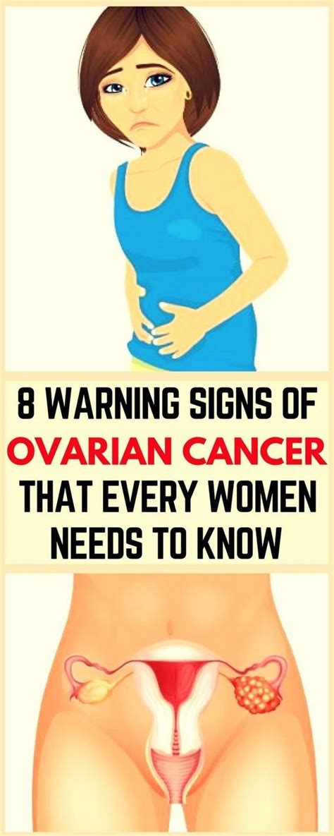 4 Early Signs Of Ovarian Cancer That Every Woman Must Know Natural Health