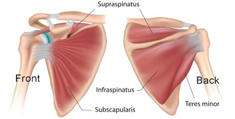 Rotator Cuff Pain Relief - Do I Need Surgery For Shoulder Pain?