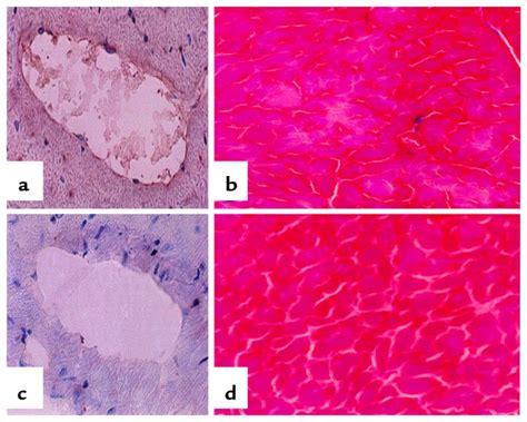 Fibrin Histology