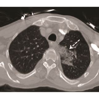 Case Ac Case Df Contrast Enhanced Ct And Volume Rendering