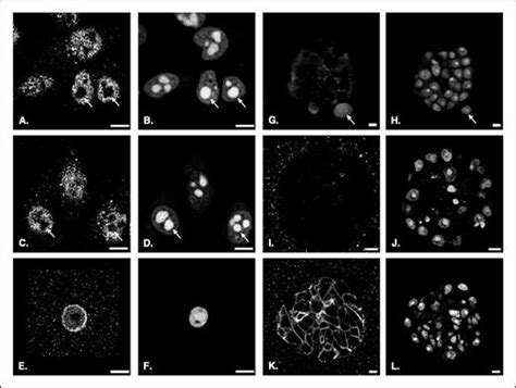 Expression And Nuclear Location Of The Transcriptional Repressor Kaiso