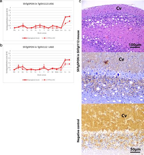 Brain Lesion Profiles And PrPres Deposit Distribution For The Inoculum