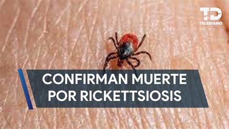 Secretar A De Salud Confirma Muerte De Dos Menores Por Rickettsiosis