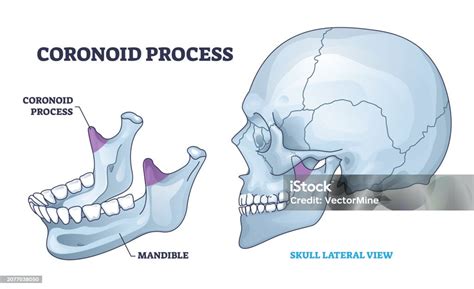 Coronoid Process Anatomy With Isolated Bone And Skull View Outline ...