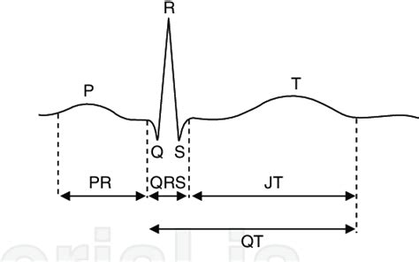 Typical Lead Ii Electrocardiographic Tracing Showing Standard