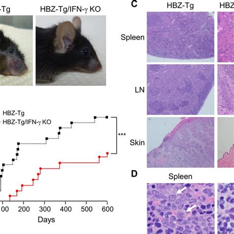 PDF Correction Interferon γ Promotes Inflammation and Development of