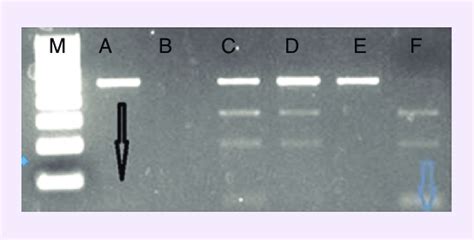 Representative Photograph Of Gel Electrophoreses On 2 Agarose Gel Of