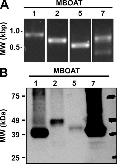 Expression Of MBOAT MRNAs In Human Neutrophils And Production Of Human