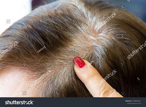 New White Hair Roots Regrowth After Stock Photo 1298899951 Shutterstock