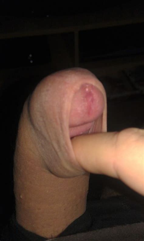 Gay Foreskin Tumblr