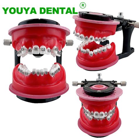 Dental Orthodontic Teeth Model With Braces Brackets Malocclusion