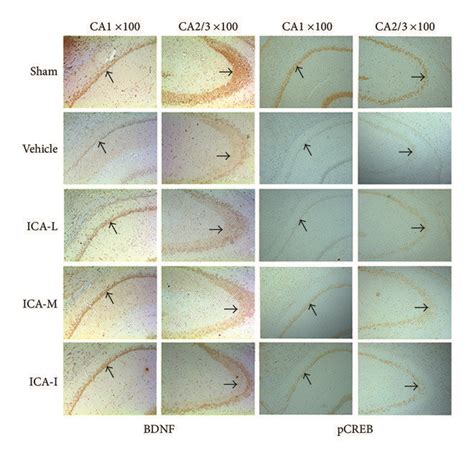 Effect Of ICA On The Expression Of BDNF And PCREB In Immunoreactive