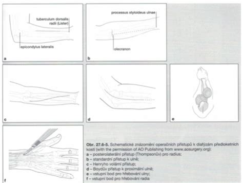 Traumatologie Flashcards Quizlet