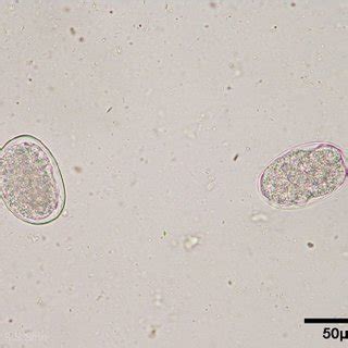 Egg packets of Dipylidium caninum. | Download Scientific Diagram