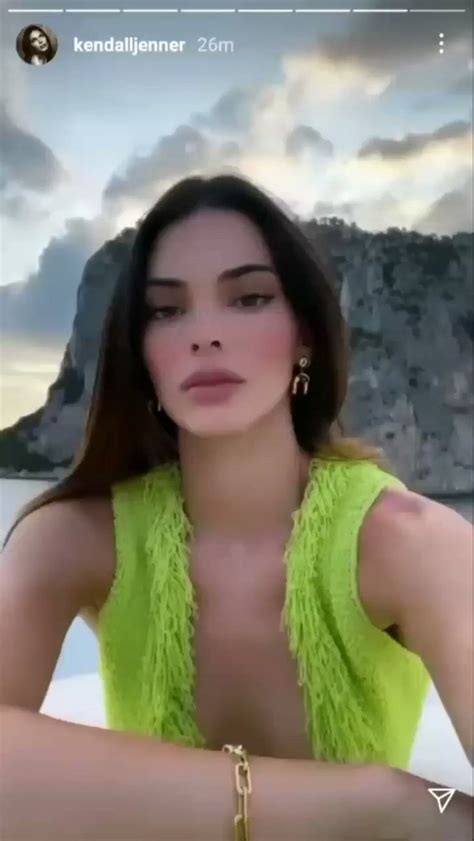 Kendall Jenner Khoe Dáng Mà Dính Luôn Nghi Vấn Tiêm Môi Và Bơm Mông