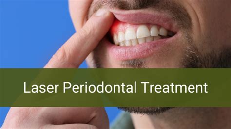 Laser Periodontal Treatment | Meyerland Family Dentistry