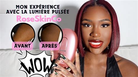 Mon ExpÉrience Avec La LumiÈre PulsÉe Roseskinco Lumi Permanent Hair